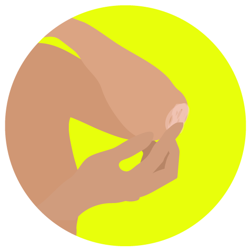 Illustration of person touching dry, flaky elbow